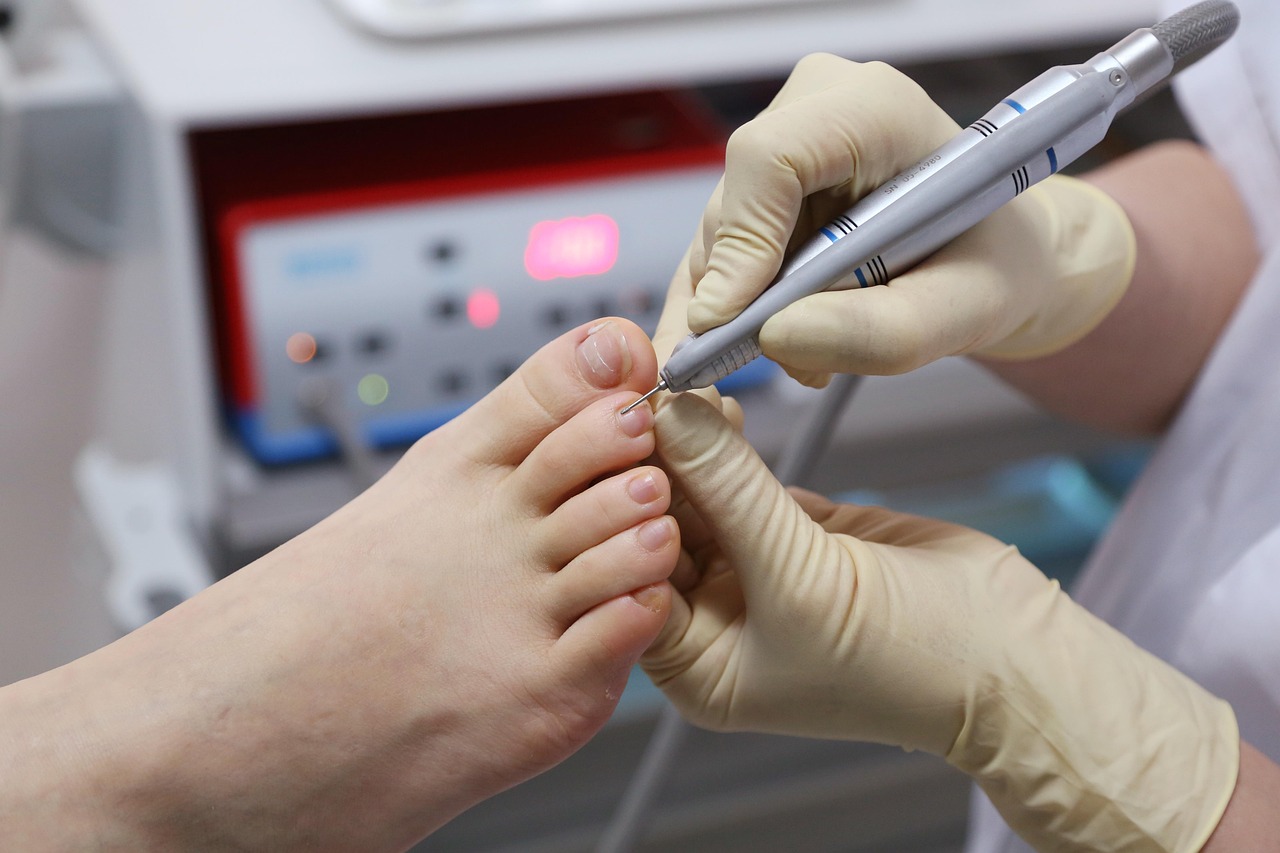 toenails, foot care, foot, nail care, toes, hygiene, hand tool, podiatrist, closeup, foot care, foot care, podiatrist, podiatrist, podiatrist, podiatrist, podiatrist