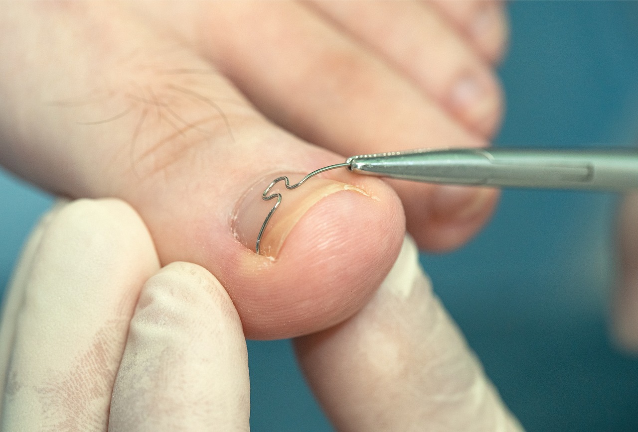 feet, foot care, podiatry, clinic, hospital, foot care, foot care, podiatry, podiatry, podiatry, podiatry, podiatry